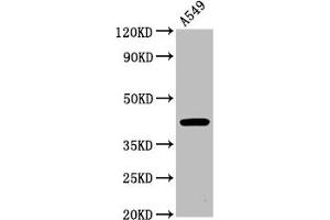 Western Blot Positive WB detected in: A549 whole cell lysate All lanes: CHST14 antibody at 4. (CHST14 antibody  (AA 70-133))