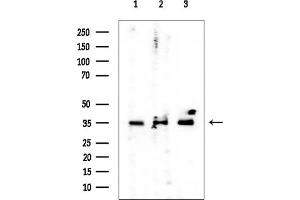 Western blot analysis of lysates from various samples, using RWDD2B Mouse Monoclonal Antibody at 1/1000 dilution. (RWDD2B antibody)