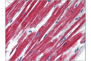Human Heart (formalin-fixed, paraffin-embedded) stained with LEPRat 4 µg/ml followed by biotinylated anti-goat IgG secondary antibody, alkaline phosphatase-streptavidin and chromogen. (Leptin Receptor antibody  (Internal Region))
