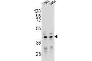 Western Blotting (WB) image for anti-Transcription Factor B2, Mitochondrial (TFB2M) antibody (ABIN2995537)