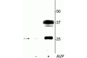 Western blot of rat kidney lysate showing specific immunolabeling of the ~29 kDa and 37 kDa glycosylated form of the AQP2 protein phosphorylated at Ser264 in the vasopressin (AVP) treated lane (+), but not in the control lane (-). (AQP2 antibody  (pSer264))