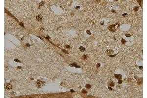 ABIN6260678 and ABIN6269215 at 1/100 staining Human brain tissue by IHC-P.