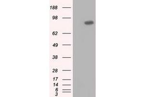 HEK293T cells were transfected with the pCMV6-ENTRY control (Left lane) or pCMV6-ENTRY USP5 (Right lane) cDNA for 48 hrs and lysed. (USP5 antibody)