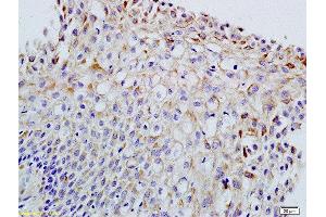 Formalin-fixed and paraffin embedded rat ovary labeled with Anti-FSH/FSHB Polyclonal Antibody, Unconjugated  at 1:200 followed by conjugation to the secondary antibody and DAB staining