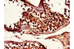 Immunohistochemistry of paraffin-embedded human testis tissue using ABIN7151222 at dilution of 1:100 (SMURF1 antibody  (AA 198-374))