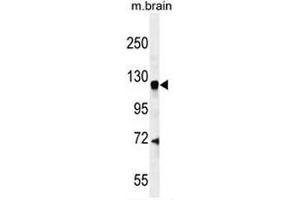 CENTG1 Antibody (C-term) western blot analysis in mouse brain tissue lysates (35µg/lane). (AGAP2 antibody  (C-Term))