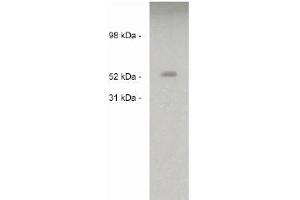 Image no. 1 for anti-Sulfatase 2 (SULF2) antibody (ABIN265173) (SULF2 antibody)