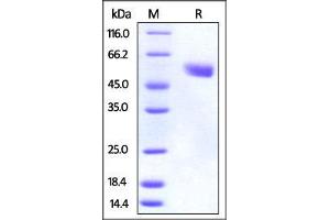 Mouse CTLA-4, Fc Tag on SDS-PAGE under reducing (R) condition. (CTLA4 Protein (AA 36-162) (Fc Tag))