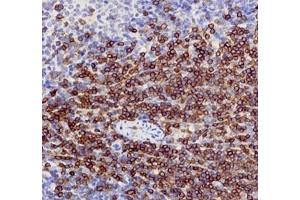 Immunohistochemistry (Paraffin-embedded Sections) (IHC (p)) image for anti-CD3 (CD3) antibody (ABIN7073386)