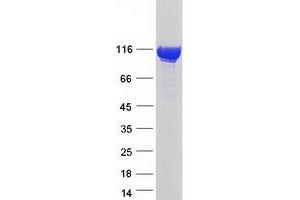 Western Blotting (WB) image for Adenosine Monophosphate Deaminase 3 (AMPD3) (Transcript Variant 1) protein (Myc-DYKDDDDK Tag) (ABIN2714668)