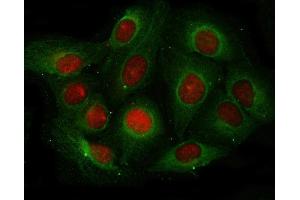 IF analysis of Angiogenin/ANG using anti-Angiogenin/ANG antibody (ABIN4886457) and anti-Beta Tubulin antibody (ABIN7602743).
