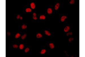 anti-Bromodomain Containing 2 (BRD2) (AA 1-50) antibody