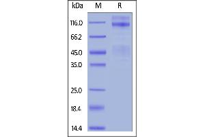 Rat IGF-I R, His Tag on  under reducing (R) condition. (IGF1R Protein (AA 31-936) (His tag))