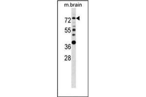 Western blot analysis of Estrogen receptor alpha  Antibody  in mouse brain tissue lysates (35ug/lane). (Estrogen Receptor alpha antibody  (AA 53-301))