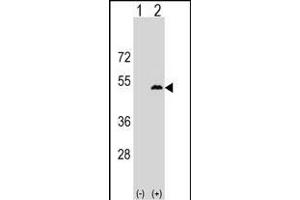 Western blot analysis of LPXN (arrow) using rabbit polyclonal LPXN Antibody (Center) (ABIN1538131 and ABIN2849342). (Leupaxin antibody  (AA 229-257))
