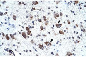Rabbit Anti-MORF4L2 Antibody ,Paraffin Embedded Tissue: Human neural cell  Cellular Data: Epithelial cells of renal tubule  Antibody Concentration: 4.