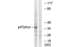 Western Blotting (WB) image for anti-Neutrophil Cytosol Factor 1 (NCF1) (AA 331-380) antibody (ABIN2888918) (NCF1 antibody  (AA 331-380))