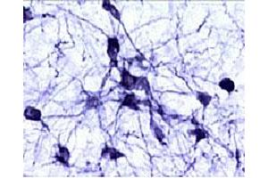 Immunohistochemical staining of catecholaminergic neurons in the rat brain stem.