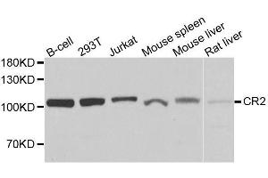 Western blot analysis of extracts of various cell lines, using CR2 antibody. (CD21 antibody  (AA 300-590))