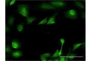 Immunofluorescence of monoclonal antibody to B3GNT3 on HeLa cell. (B3GNT3 antibody  (AA 135-208))