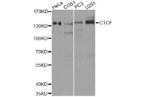 Western blot analysis of extracts of various cell lines, using CTCF antibody. (CTCF antibody  (AA 1-260))