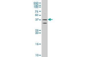 ATP6V0D2 polyclonal antibody (A01), Lot # 051130JC01 Western Blot analysis of ATP6V0D2 expression in Y-79 .