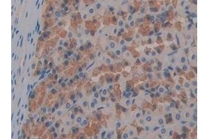 Detection of FABP9 in Rat Stomach Tissue using Polyclonal Antibody to Fatty Acid Binding Protein 9, Testis (FABP9) (FABP9 antibody  (AA 1-130))