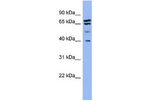 WB Suggested Anti-SH3GL2  Antibody Titration: 0. (SH3G2 antibody  (Middle Region))