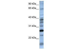 WB Suggested Anti-DOLPP1 Antibody Titration:  0. (DOLPP1 antibody  (N-Term))