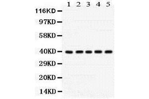 Western Blotting (WB) image for anti-Cyclin-Dependent Kinase 7 (CDK7) (AA 31-346) antibody (ABIN3042742) (CDK7 antibody  (AA 31-346))