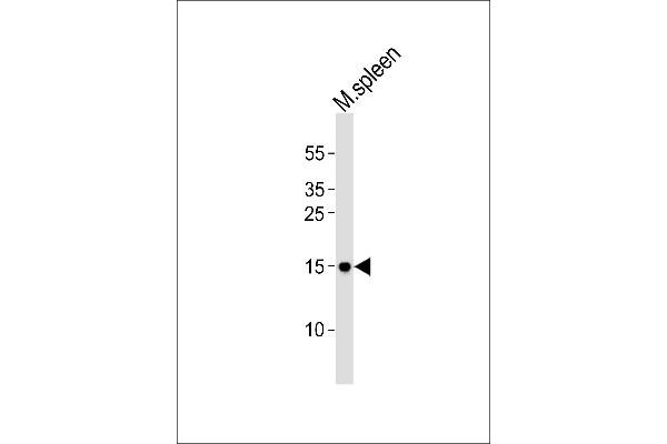 POLR2H anticorps  (N-Term)