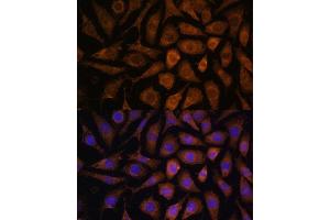 Immunofluorescence analysis of L929 cells using M Polyclonal Antibody (ABIN7268628) at dilution of 1:100 (40x lens). (MAPK6 antibody  (AA 372-721))