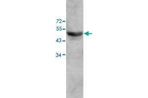 Western blot analysis of human fetal colon lysate with ZC3H10 polyclonal antibody  at 1 : 500 dilution. (ZC3H10 antibody  (AA 136-412))