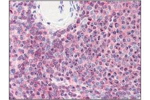 Immunohistochemistry (IHC) image for anti-Cofilin 1 (CFL1) (AA 1-166), (N-Term) antibody (ABIN336102) (Cofilin antibody  (N-Term))