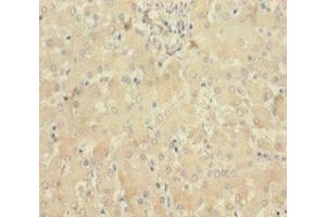 Immunohistochemistry of paraffin-embedded human liver tissue using ABIN7160100 at dilution of 1:100 (MLKL antibody  (AA 1-471))