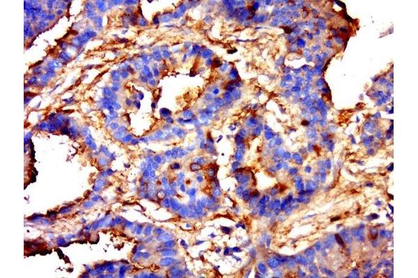 RBFA antibody
