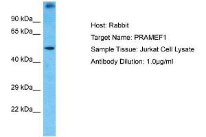 Host: Rabbit Target Name: PRAMEF1 Sample Type: Jurkat Whole Cell lysates Antibody Dilution: 1.