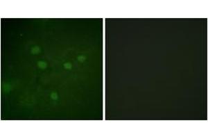 Immunofluorescence analysis of COS7 cells, using NFAT5 (Phospho-Ser1197) Antibody. (NFAT5 antibody  (pSer1197))
