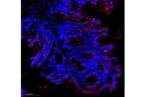 Immunofluorescence of paraffin embedded mouse colon using groucho (ABIN7075961) at dilution of 1:1000 (300x lens) (TLE1 antibody)