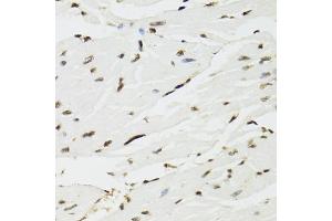 Immunohistochemistry of paraffin-embedded mouse heart using EDF1 antibody (ABIN5971272) at dilution of 1/100 (40x lens). (EDF1 antibody)