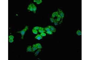 Immunofluorescent analysis of HepG2 cells using ABIN7159567 at dilution of 1:100 and Alexa Fluor 488-congugated AffiniPure Goat Anti-Rabbit IgG(H+L) (MTX2 antibody  (AA 1-263))