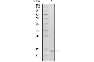 Western Blot showing EhpB6 antibody used against truncated EhpB6 recombinant protein (1).