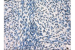 Immunohistochemical staining of paraffin-embedded endometrium tissue using anti-FRKmouse monoclonal antibody. (FRK antibody)