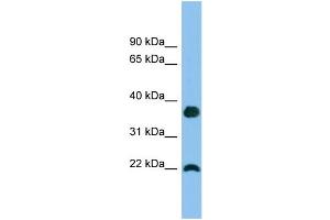 WB Suggested Anti-WFDC1 Antibody Titration: 0. (WFDC1 antibody  (Middle Region))