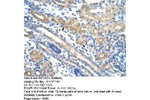 Rabbit Anti-RPUSD2 Antibody  Paraffin Embedded Tissue: Human Kidney Cellular Data: Epithelial cells of renal tubule Antibody Concentration: 4.