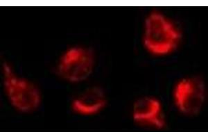 ABIN6276210 staining K562 by IF/ICC. (GPRC5A antibody  (Internal Region))
