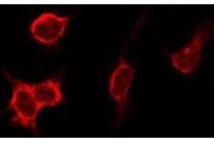 ABIN6275888 staining HeLa by IF/ICC. (Cathepsin D antibody  (C-Term))