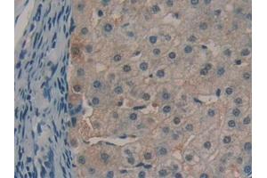 Immunohistochemistry (IHC) image for anti-alpha-2-Glycoprotein 1, Zinc-Binding (AZGP1) (AA 148-298) antibody (ABIN7438511)
