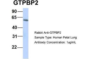 Host:  Rabbit  Target Name:  GTPBP2  Sample Type:  Human Fetal Lung  Antibody Dilution:  1. (GTPBP2 antibody  (N-Term))