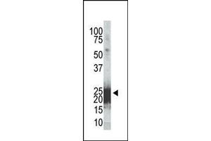 Western analysis of cell extracts from 293 cells transfected with Flag-Bad, using Phospho-mBad-Ser155 Antibody. (BAD antibody  (pSer155))